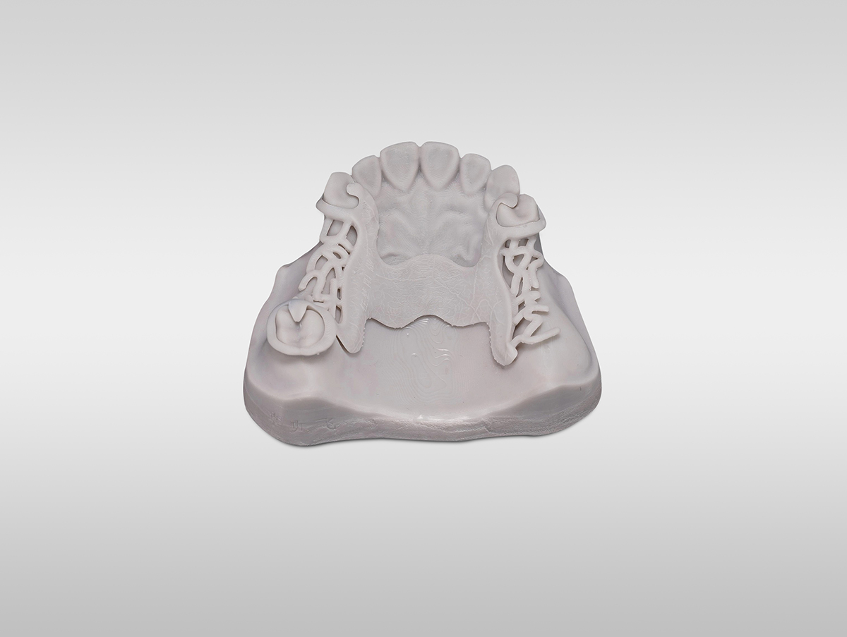 Cubeta de resina de una impresora 3D dental