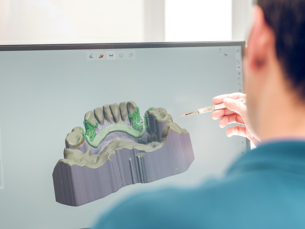 Ingenieros y profesionales analizando aplicaciones industriales y dentales de impresión 3D de resina