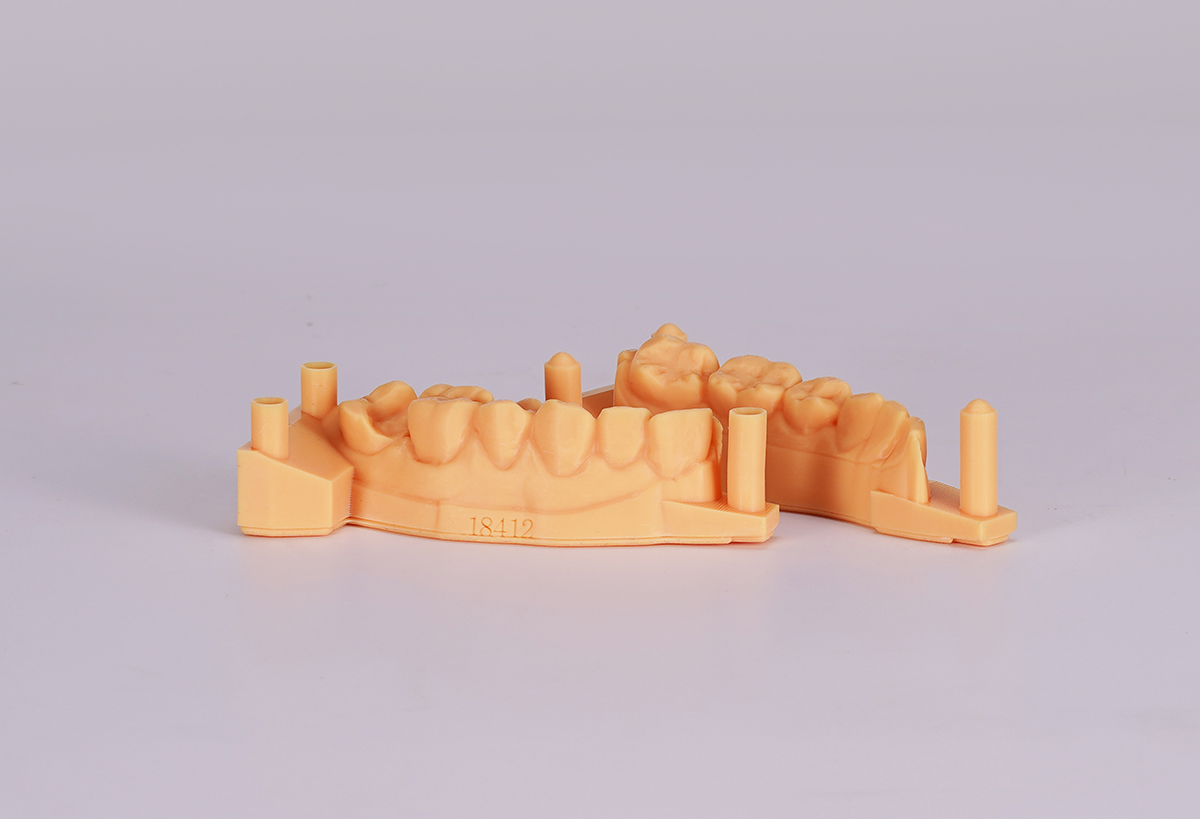 Modelo de ortodoncia impreso en una impresora 3D dental
